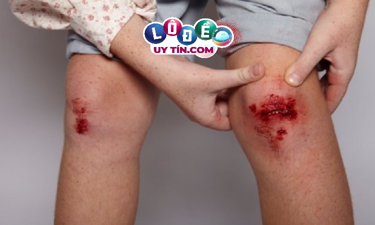 Mơ thấy máu là điềm gì, đánh con gì?