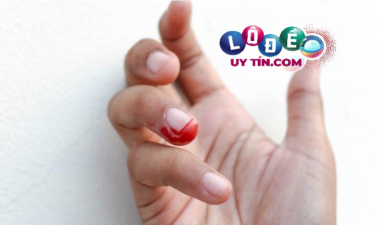 Phân tích ý nghĩa xung quanh giấc mơ thấy đứt tay chảy máu 3 Phân tích ý nghĩa xung quanh giấc mơ thấy đứt tay chảy máu 1