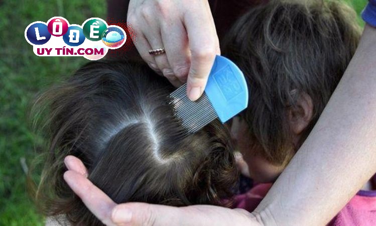 Nằm mơ thấy con chấy đánh con gì dễ ăn 2