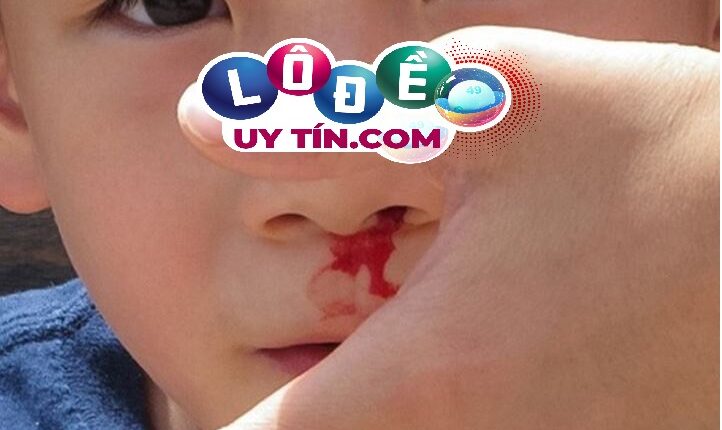 Mơ thấy chảy máu mũi, máu cam là điềm gì, đánh con gì? 2 mơ thấy chảy máu mũi