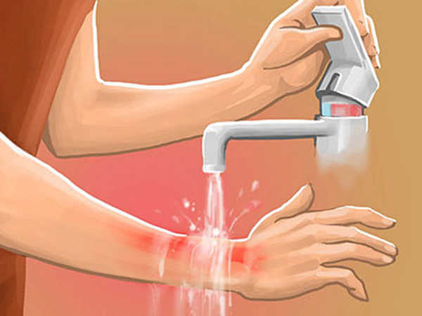 mơ bị bỏng nước sôi